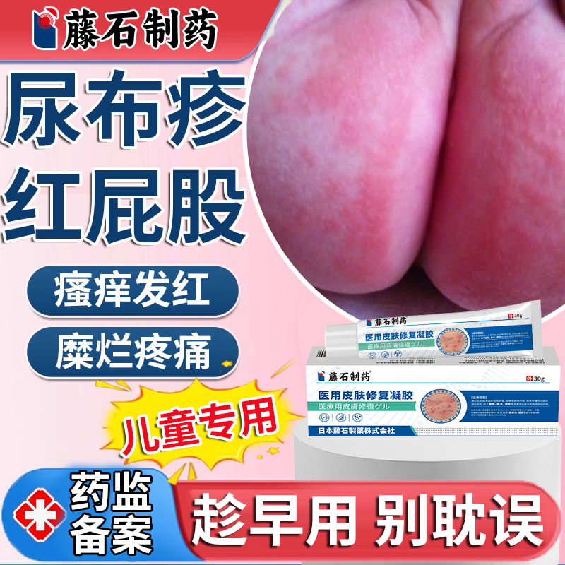 尿布疹湿疹膏红屁屁宝宝老人红屁股小孩非婴幼儿擦粉药监备案膏EM