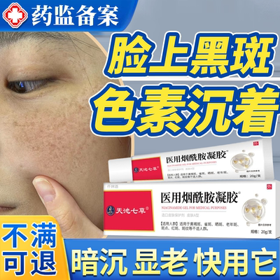 医用烟酰胺】祛脸上黑斑色素沉着