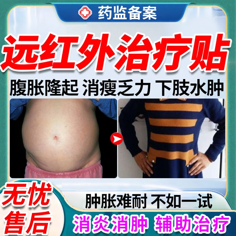 肝硬化腹水肝痛贴专用脂肪肝肝囊肿舒肝贴养肝护肝正品中膏药贴OZ