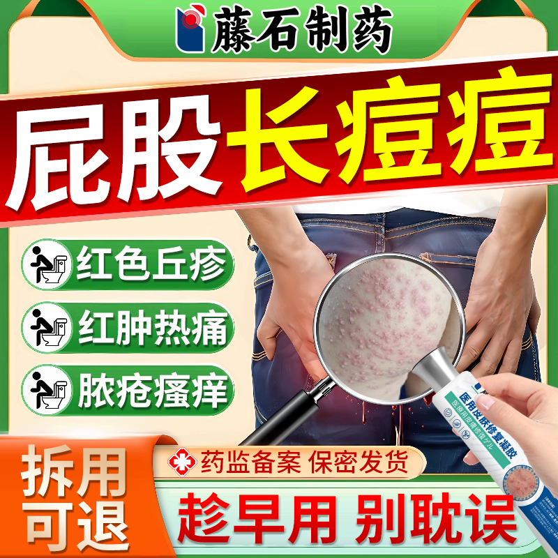 【医用级】屁股长红肿脓包痘凝胶