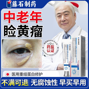 眼睑黄瘤睑黄瘤去除神器睑黄疣眼皮黄斑瘤专用眼部眼角药房款膏OZ