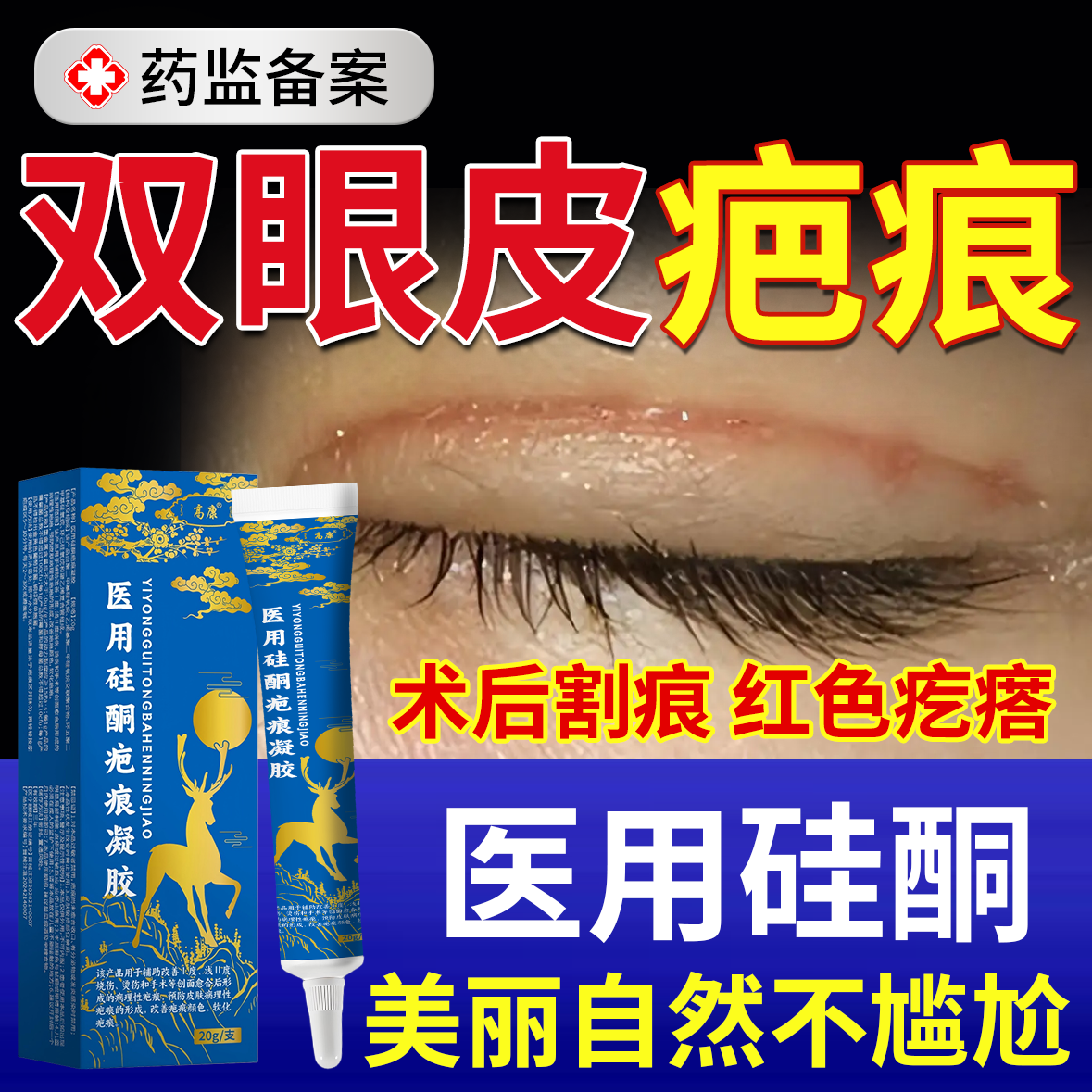 割双眼皮术后祛疤膏消肿神器疤痕修复除疤膏疤痕膏全切手术增生OZ