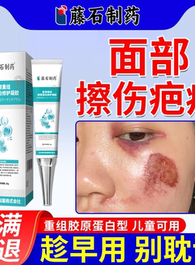 脸上擦伤疤痕去疤印黑色素沉淀去除摔伤破皮脸部修复除疤祛疤膏JW