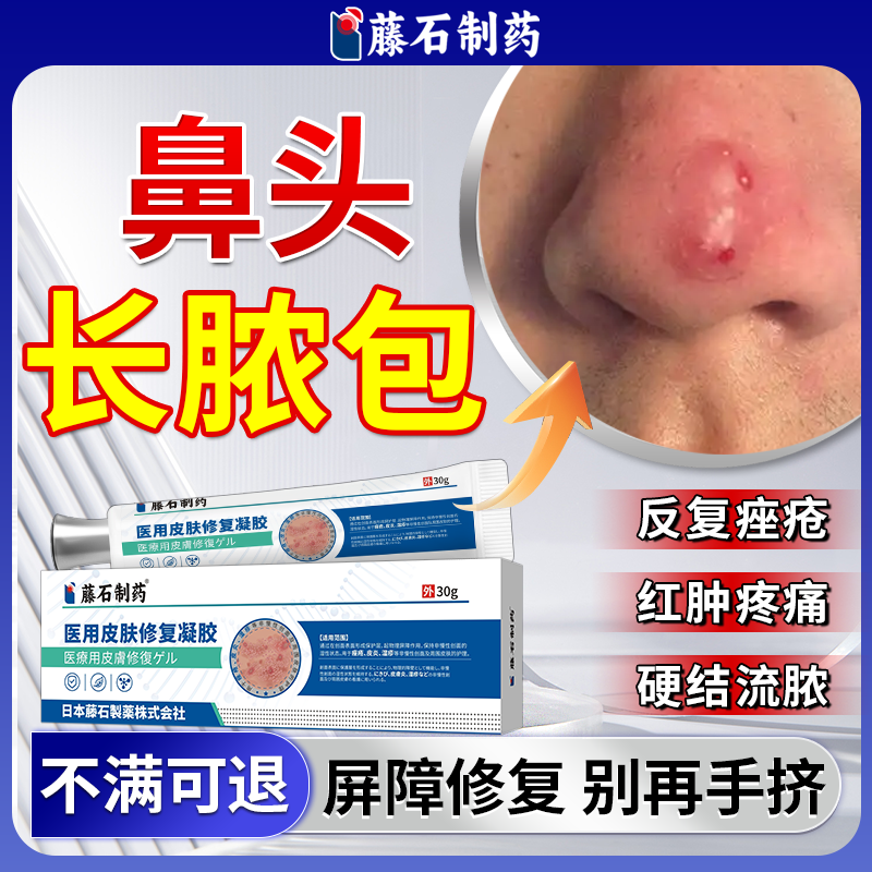 藤石制药】鼻子长脓包痘痘修复膏