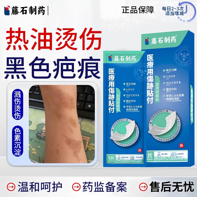被油溅烫伤烧伤去疤膏疤痕修复除疤膏去黑印黑色素沉淀烧伤凝胶EM