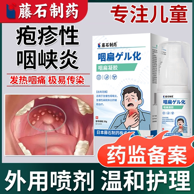 疱疹性咽峡炎】专注儿童不满可退