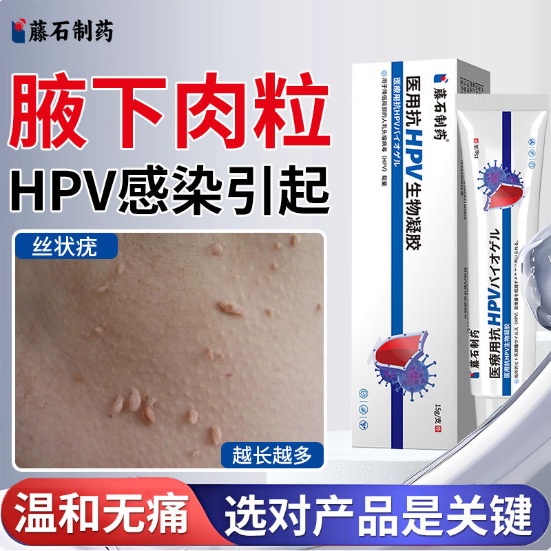 丝状疣腋下小肉粒肉瘤去肉痣小肉揪去除神器hpv去疣药房同款膏JW