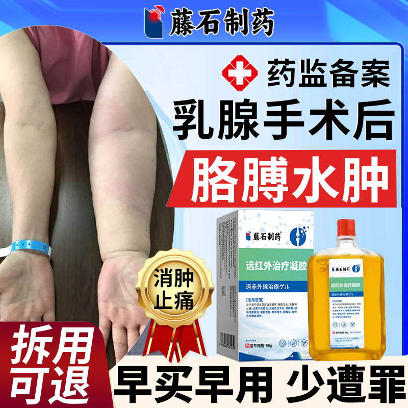 乳腺术后上肢淋巴水肿可搭压力袖套绷带手套防手臂胳膊肿胀医用JW