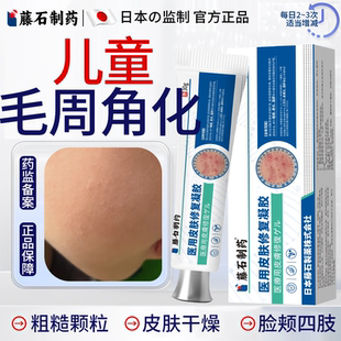 儿童毛周角化医用皮肤修复凝胶葵毛周角化症小颗粒去除花鸡皮肤OZ