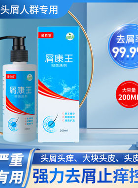 屑康王去严重头皮屑头皮长痘止痒
