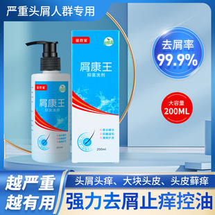 去屑止痒洗发水正品严重头屑头痒除螨头皮屑控油洗头膏男女