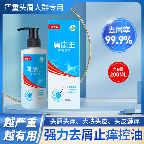 屑康王去严重头皮屑头皮长痘止痒