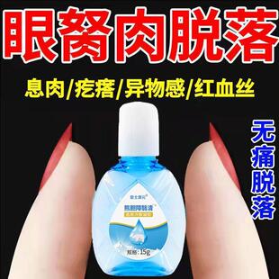 眼睛胬肉滴眼液去除眼睛胬肉翼状眼干眼红异物感疙瘩红血丝眼药水
