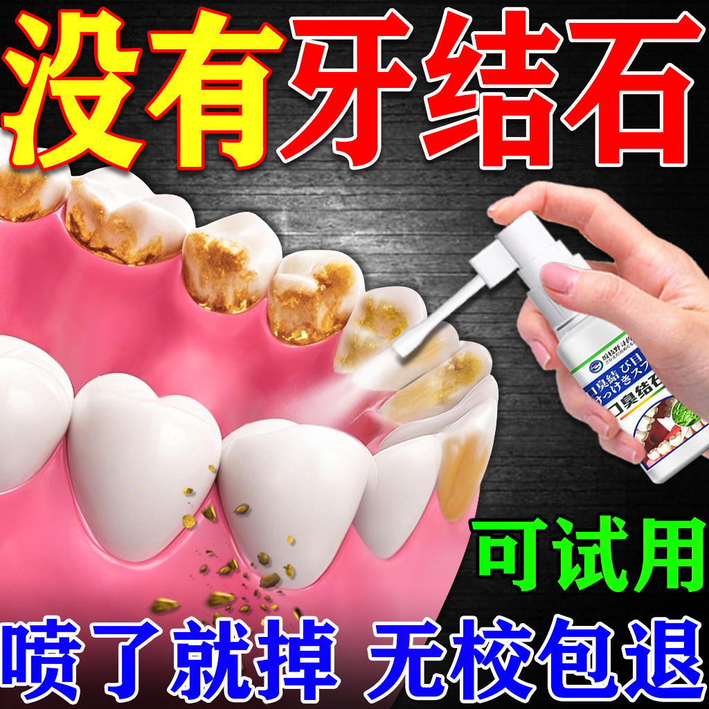 医用去牙结石溶解牙石速效清理清洗牙垢牙结石清除神器溶解喷雾剂