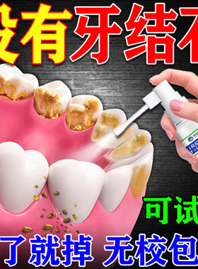 【一喷见效】快速清除牙结石喷剂