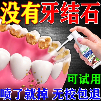 【一喷见效】快速清除牙结石喷剂