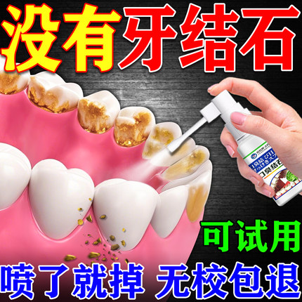 医用去牙结石溶解牙石速效清理清洗牙垢牙结石清除神器溶解喷雾剂
