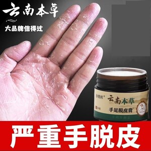 云南手足脱皮膏手指上起皮干燥抑菌儿童手掌蜕皮手心手脚掉皮专用