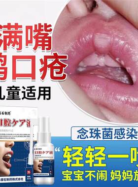儿童鹅口疮喷剂可搭碳酸氢