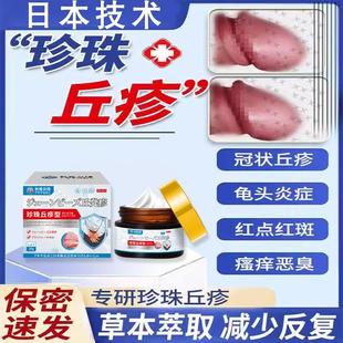龟头炎症冠状沟珍珠疹去除专用系带旁丘疹颗粒皮脂腺异位症膏X