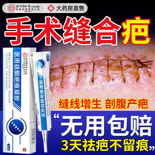 手术缝针疤痕专用祛疤膏修复去除疤痕剖腹产甲状腺增生凸起旗舰店