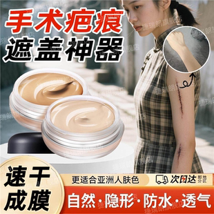 疤痕隐形贴纹身遮盖手术疤痕神器肉色遮瑕膏胎记伤疤凹凸疤增生lc