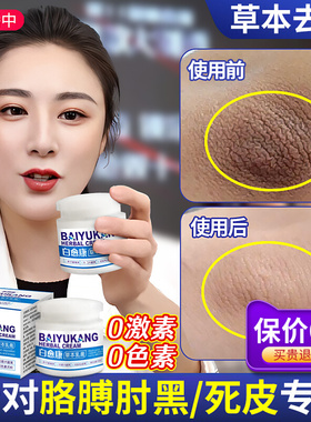 手肘脖子腋下屁股坐印发黑神器