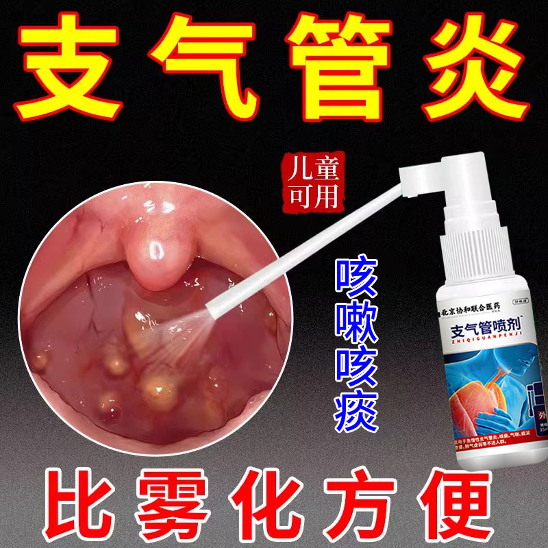 支气管炎哮喘的喷雾剂止咳化痰祛痰干咳久咳咳嗽止咳儿童急慢性QY
