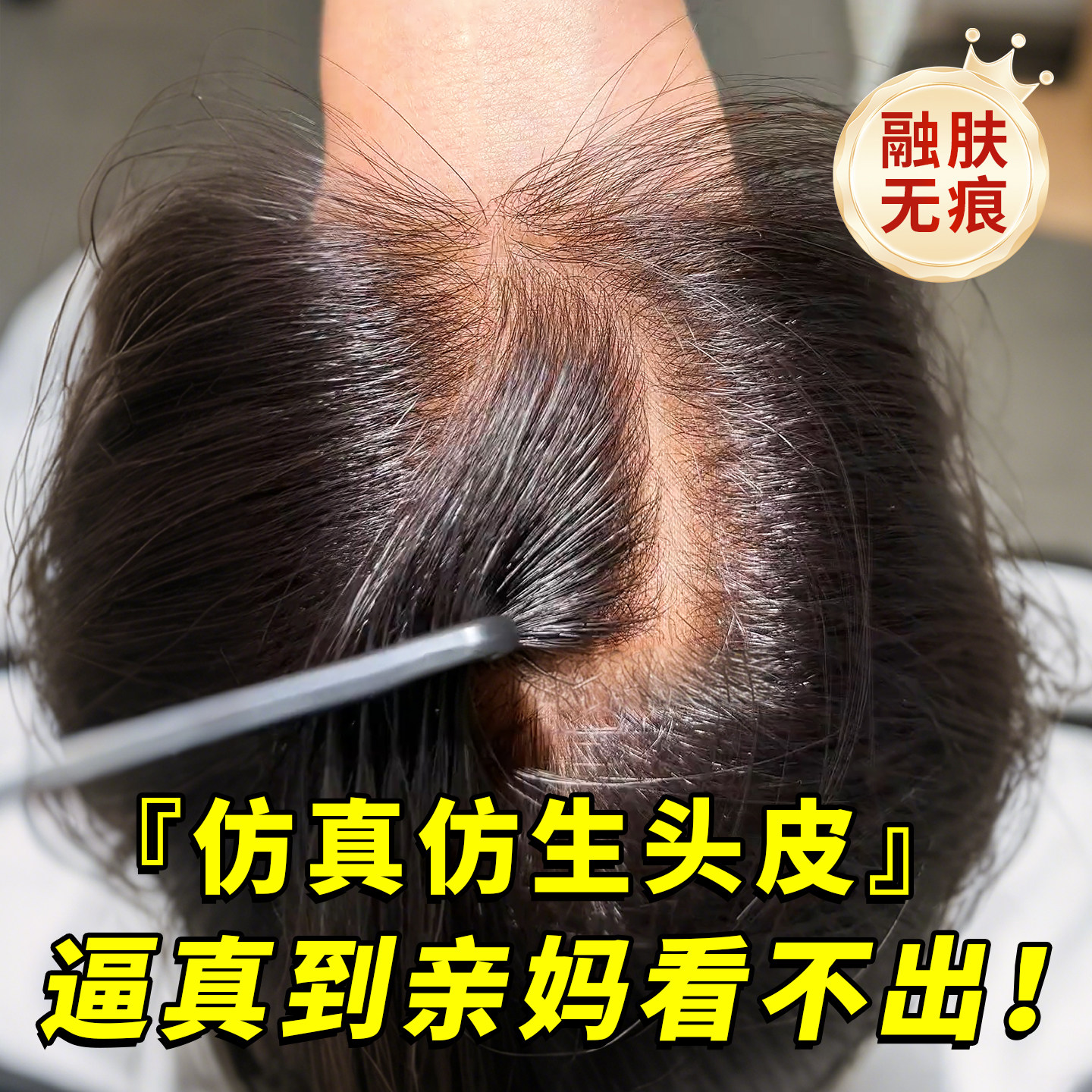 【氧气呼吸感】发片头顶补发蓬松