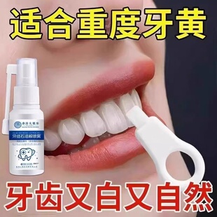 医用型去牙结石溶解剂牙石清理洗牙齿污垢美白去黄牙烟渍清洁神器