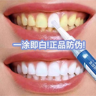速效牙齿清洁神器炫白洁牙笔去黄烟茶渍增白牙贴专克大黄牙咖喱笔