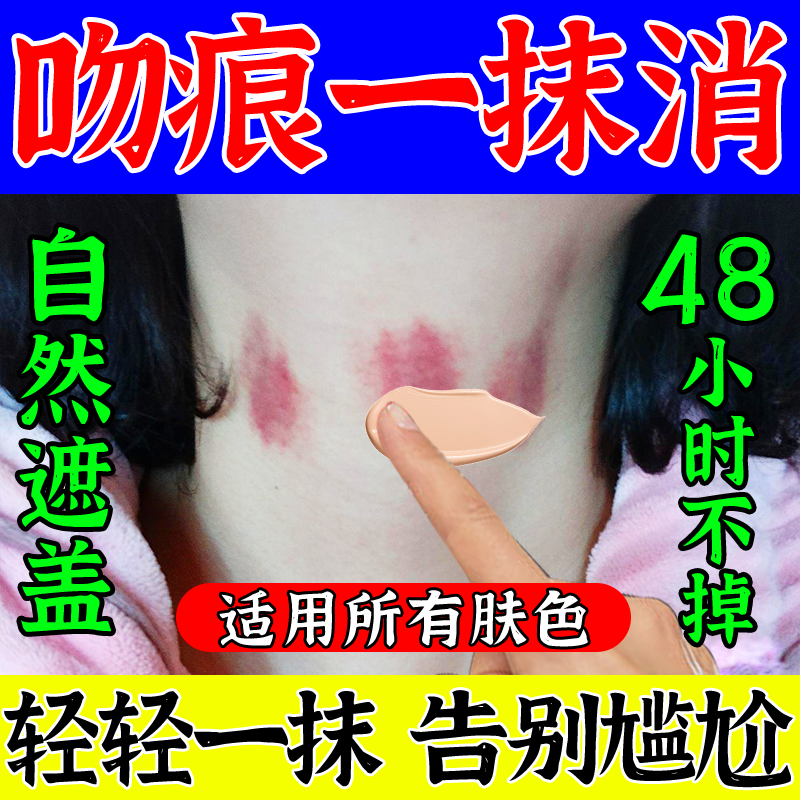 吻痕消除神器修复膏吻痕贴草莓印去颈部草莓脖子专用去疤痕膏遮盖