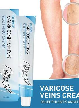 Improve Blood Circulation Varicose Veins Treatment Cream