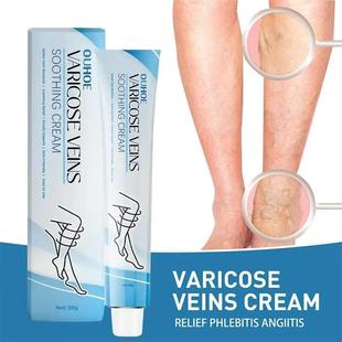 Improve Blood Circulation Varicose Veins Treatment Cream