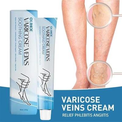 Improve Blood Circulation Varicose Veins Treatment Cream