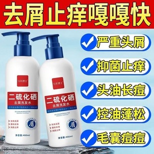 二硫化硒洗发水脂溢性皮炎毛囊炎头皮屑面部去屑止痒抑菌专用除螨