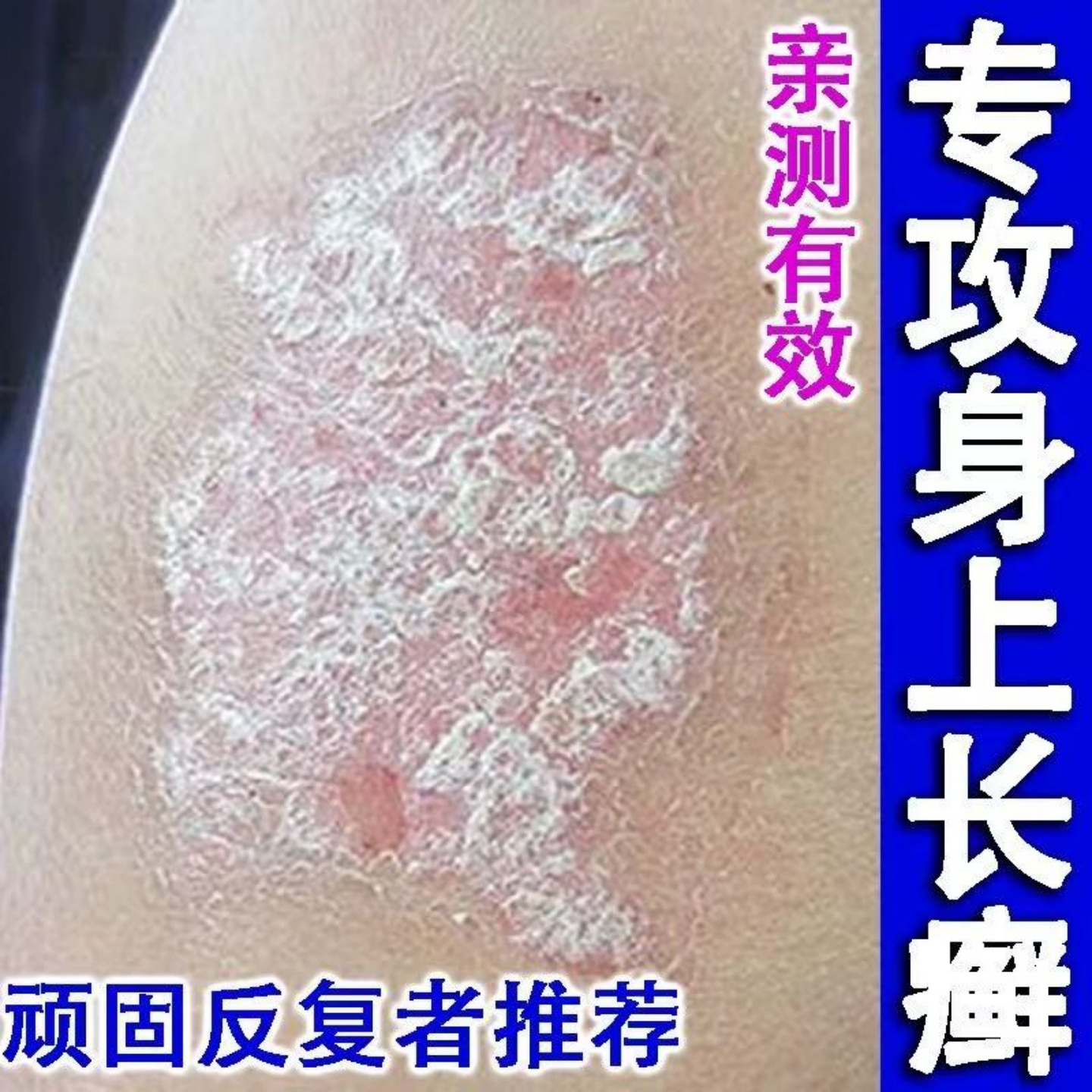 香港大药房【牛藓王救星】