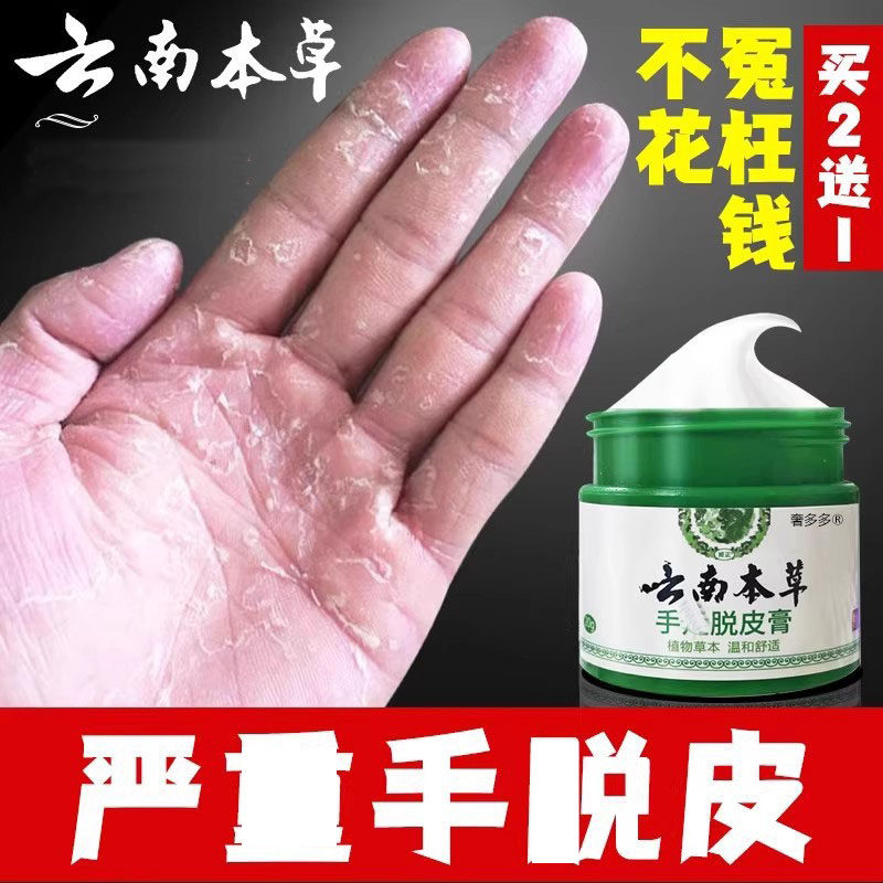 手脱皮膏足手指上起皮干 干燥爆皮儿童手掌蜕皮手心手脚掉皮褪头