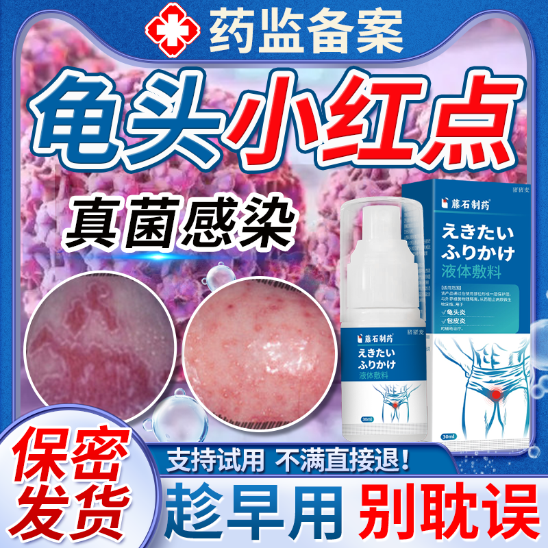 龟头上长小红点红斑龟头包皮炎专真菌感染炎症用瘙痒药房同款膏EM