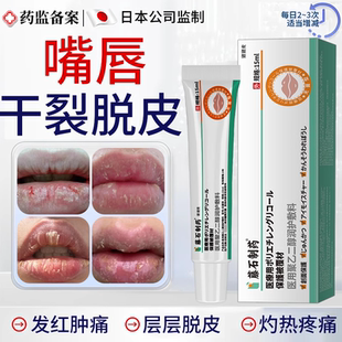 剥脱性唇炎唇膏嘴唇干裂脱皮专用医用型儿童口周炎薬房同款膏JW