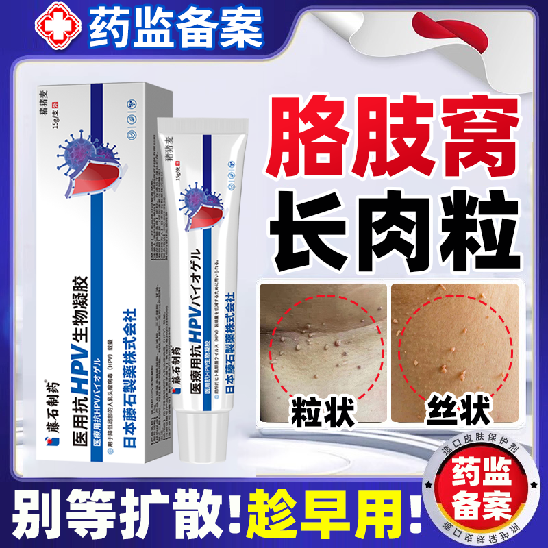 再合成丝状疣胳肢窝腋下小肉粒皮赘去除神器hpv疣药房同款膏EM