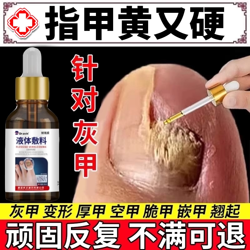 【直击灰甲不伤好甲】不满可退