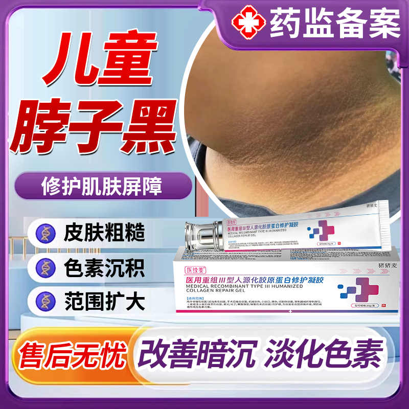 医用型肥胖儿童去脖子黑棘皮病药房同款膏黑皮肤黑色素沉淀去除MP