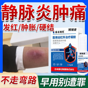 静脉炎专用消肿理疗敷贴输液后胳膊血管疼止痛恢复可搭薬膏OZ