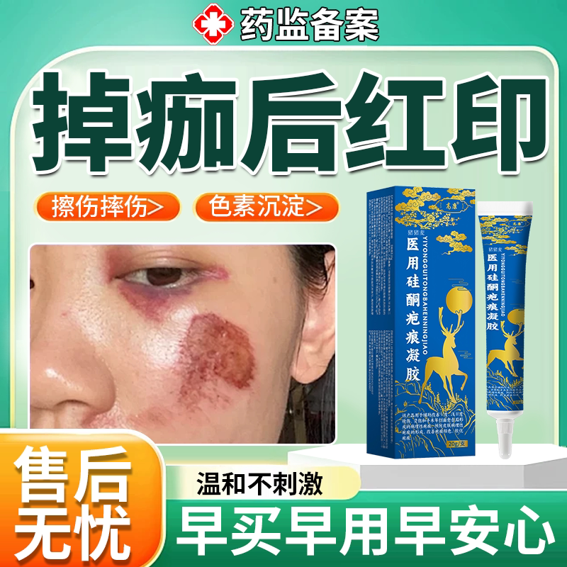 【医用级别】掉痂后红印疤痕软膏图片