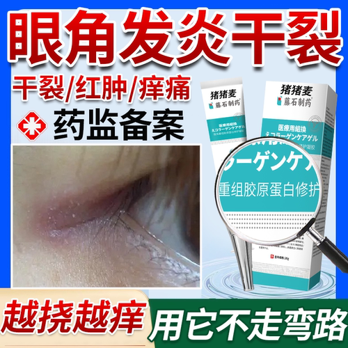 眼角发炎干裂】直击根源不走弯路