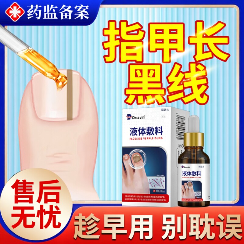 甲母痣黑指甲专用膏去指甲有长黑线黑色竖纹手指甲淤血薬房同款JW