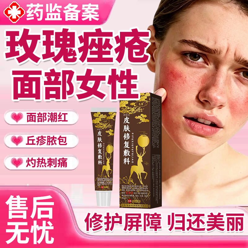 玫瑰痤疮特效屏障修复专用祛痘痘修复消痘印炎精华薬房同款软膏MP