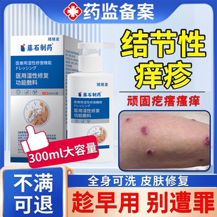 结节性痒疹特皮肤湿疹效治顽固红硬疙瘩搭药房同款膏虫咬性皮炎OZ