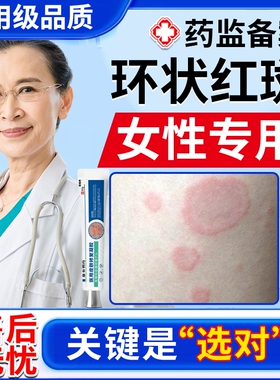 离心性环形状红斑湿疹体癣肉芽肿狼疮多形接触性丘疹药房同款膏BS